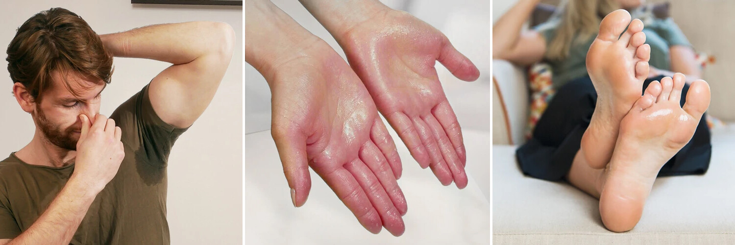 Hyperhidrose oder übermäßiges Schwitzen der Handflächen, Fußsohlen oder Achseln