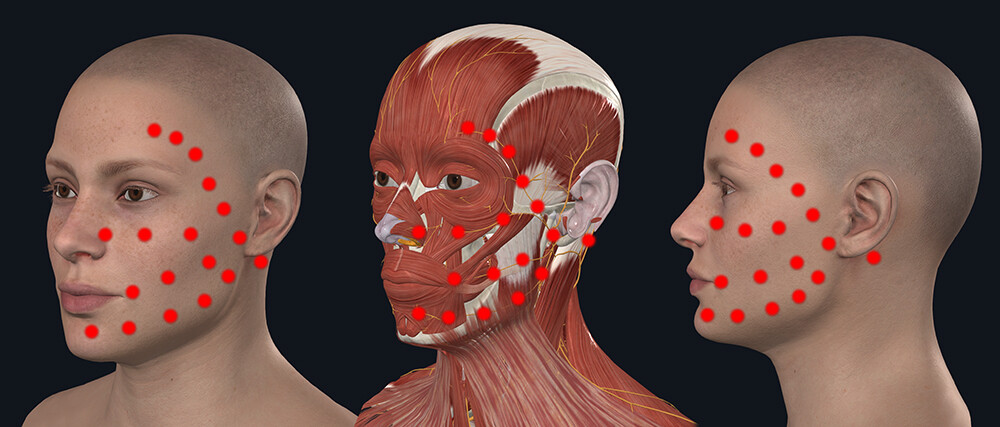 Treatment points of Facial nerve palsy, Bell's palsy, trigeminal neuralgia