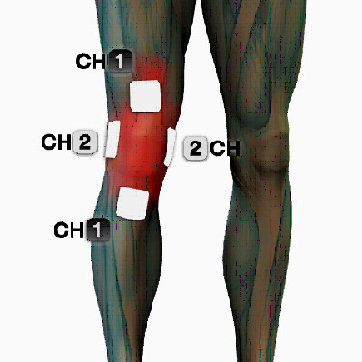 microcurrent knee pain treatment points electrode placement