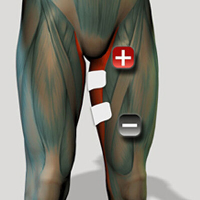 Adduktoren Muskel Elektrodenplatzierung für Muskelstimulator