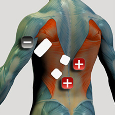 Amplasarea electrozilor pentru mușchiul spatelui pentru stimulatorul muscular