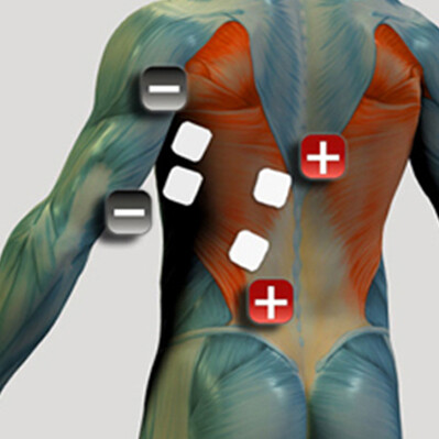 Platzierung der Rückenmuskelelektroden für den Muskelstimulator