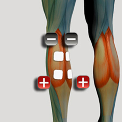 Amplasarea electrozilor pentru mușchiul gambei pentru stimulatorul muscular