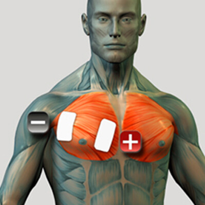 Platzierung der Brustmuskelelektroden für den Muskelstimulator