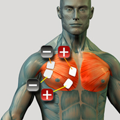 Platzierung der Brustmuskelelektroden für den Muskelstimulator
