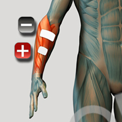 Platzierung der Elektroden des Unterarmstreckmuskels für den Muskelstimulator