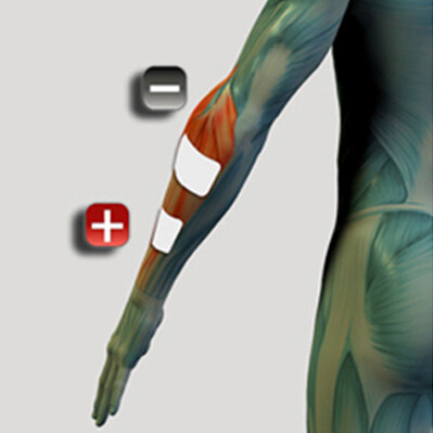 Platzierung der Unterarm-Elektroden für den Muskelstimulator