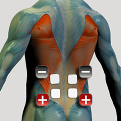 Amplasarea electrozilor pentru mușchii din partea inferioară a spatelui pentru stimulatorul muscular