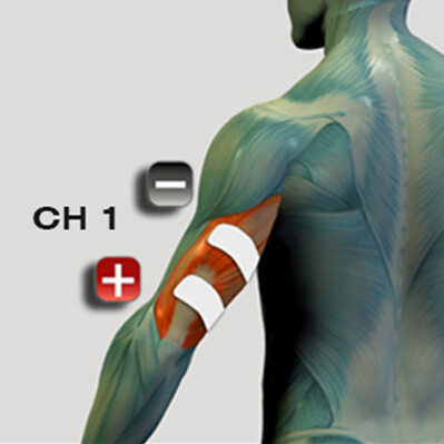 Platzierung der Trizeps-Muskelelektroden für den Muskelstimulator