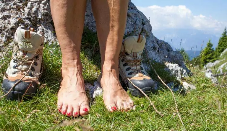 Varicose veins: Symtoms, Causes and Treatment